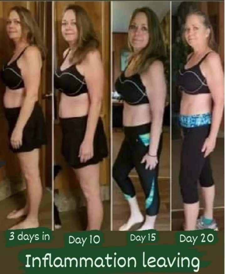 Perdida de inflamación abdominal
